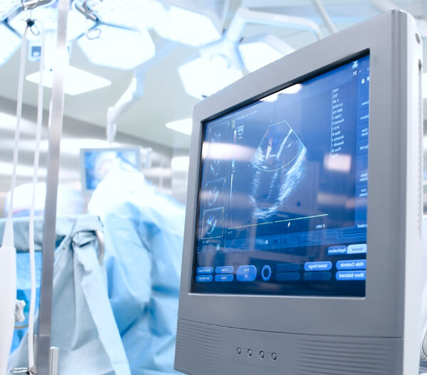 Qué es una ecografía y para qué sirve